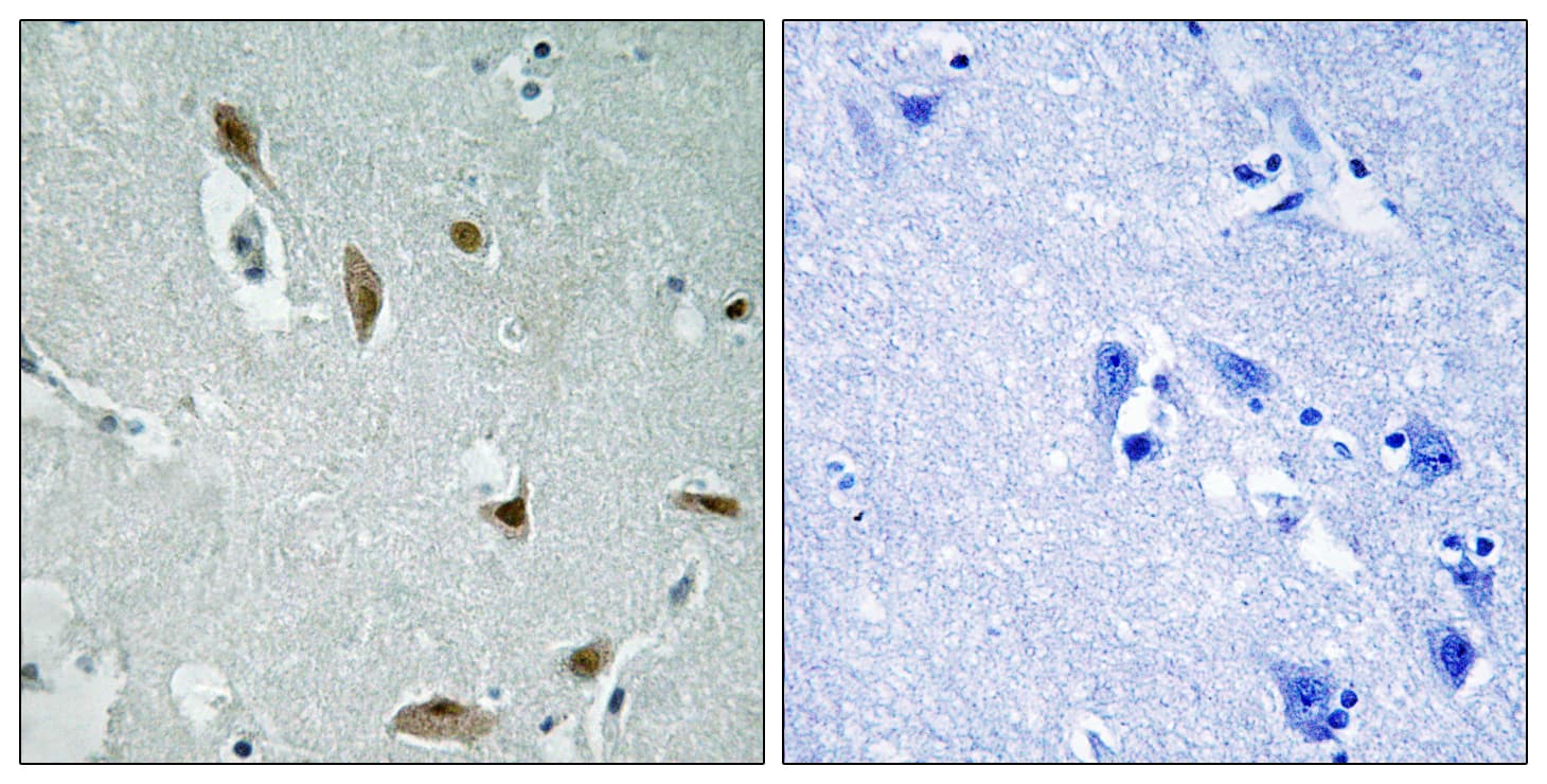 AKT1 + AKT3 Antibody (phospho-Tyr437/Tyr434)