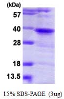 Human TWF1 / PTK9 Protein (Recombinant His)