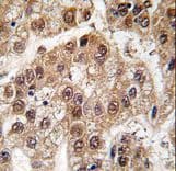 Polyclonal Rabbit anti-Human U2AF1 Antibody (aa55-83, IHC, WB)