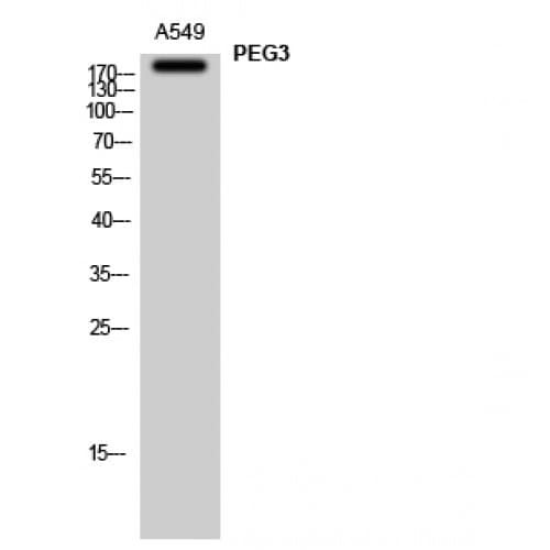 PEG3 Antibody (1010-1090 aa, Internal)