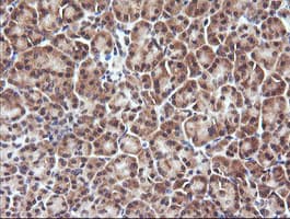 DDX58 / RIG-1 / RIG-I Antibody (clone OTI8D2)