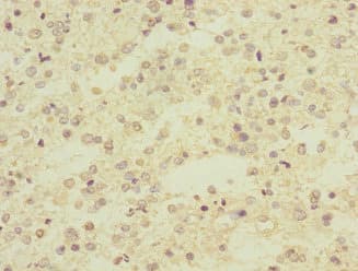 Polyclonal Rabbit anti-Human ARPC5 / p16-Arc Antibody (IHC)