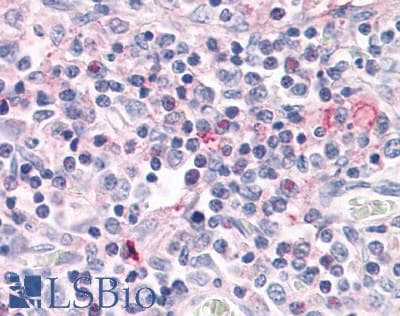 PathPlus™ Polyclonal Rabbit anti-Human RORC / ROR Gamma Antibody (Ligand-binding Domain, IHC)