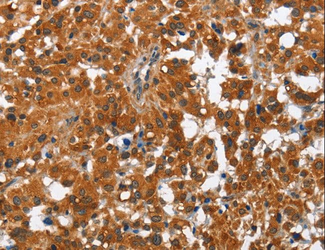 Polyclonal Rabbit anti-Human PAK2 Antibody (IHC)