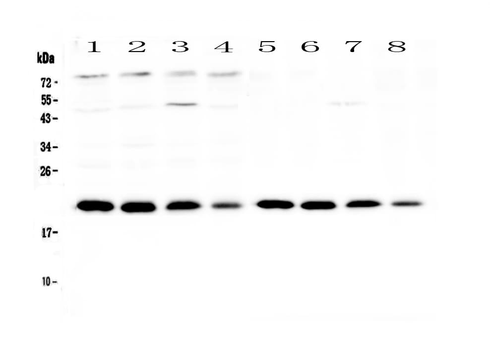 Monoclonal Mouse anti-Human NIP3 / BNIP3 Antibody (WB)