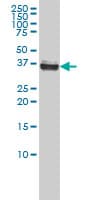 Monoclonal Mouse anti-Human NPM1 / NPM / Nucleophosmin Antibody (clone 3B2, IF, WB)