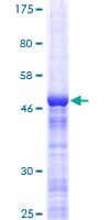 Human RPL13 / Ribosomal Protein L13 (Recombinant GST)