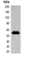 Polyclonal Rabbit EBFP Tag Antibody (WB)