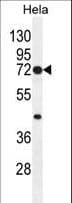 PTGS2 / COX2 / COX-2 Antibody (aa363-391)