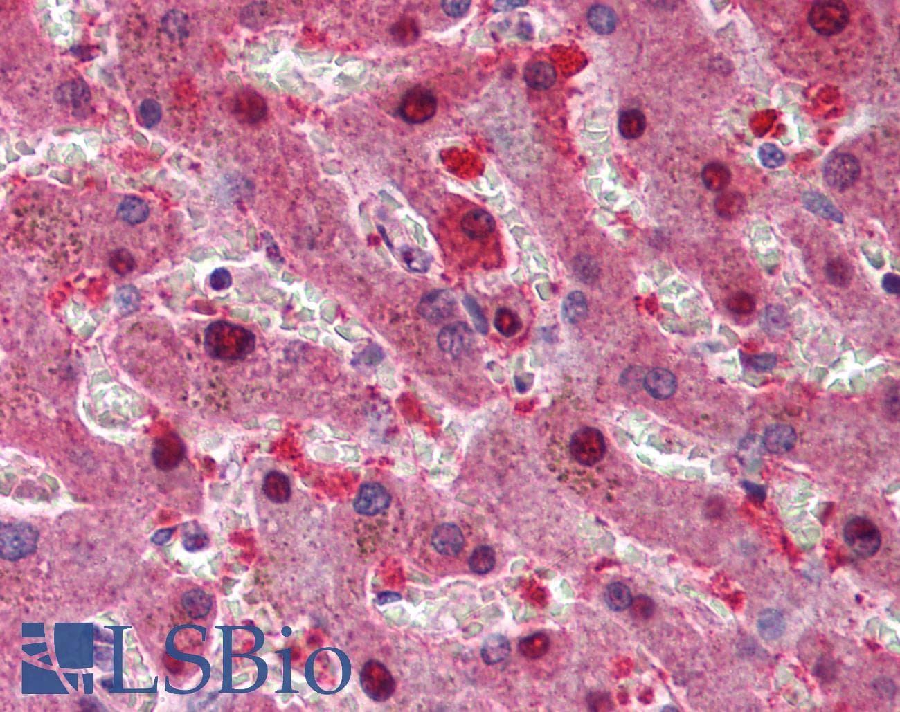IHC-plus™ p16INK4a / CDKN2A Antibody (aa91-105)