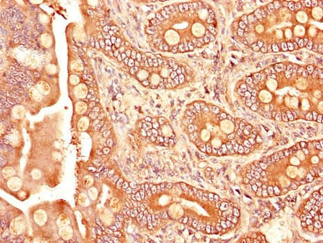 Polyclonal Rabbit anti-Human TGFBR1 / ALK5 Antibody (IHC, IF, WB)
