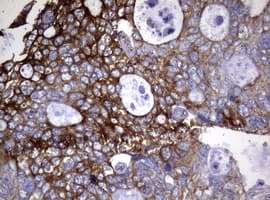 Monoclonal Mouse anti-Human TS / Thymidylate Synthase Antibody (clone 10F12, Carrier-free, IHC, WB)