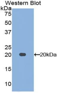 MDK / Midkine Antibody (aa22-143, clone C1)