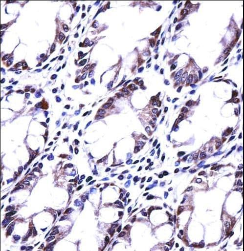 HRASLS5 Antibody (aa100-129)
