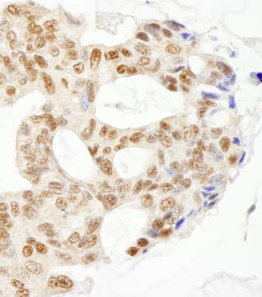 Polyclonal Rabbit anti-Human ERCC5 / XPG Antibody (aa650-700, IHC, WB)