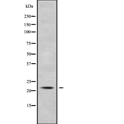 KCNMB1 Antibody