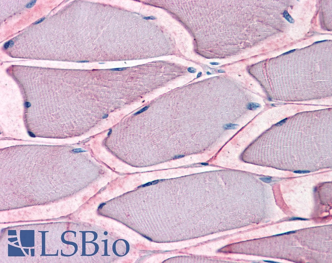 IHC-plus™ Polyclonal Rabbit anti-Human SLC1A5 / ASCT2 Antibody (Internal, IHC)