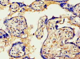 VG5Q / AGGF1 Antibody (aa1-70)