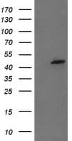 Mannose Phosphate Isomerase Antibody (clone OTI4G7)