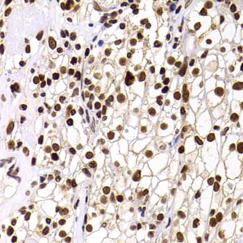 WDR11 / PHIP Antibody