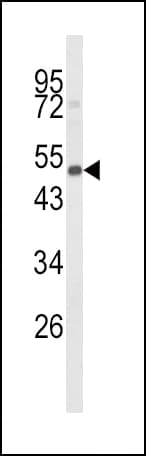 CYP24 / CYP24A1 Antibody (aa466-494)