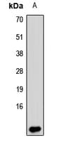 Polyclonal Rabbit anti-Human S100B / S100 Beta Antibody (WB)