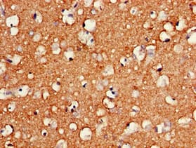HMG2 / HMGB2 Antibody