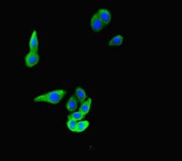 Polyclonal Rabbit anti-Human FAT4 Antibody (IF)