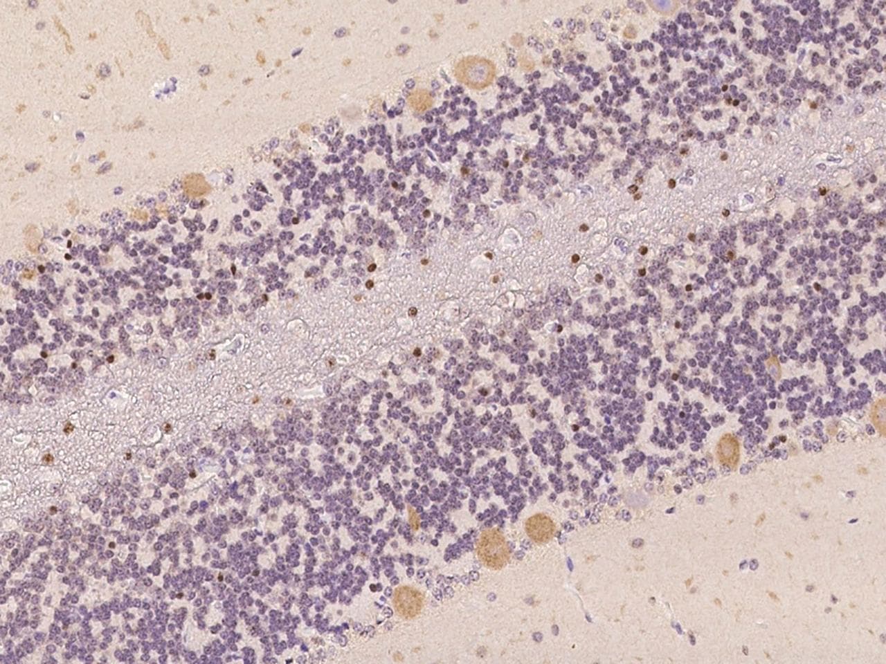 GRIN2B / NMDAR2B / NR2B Antibody