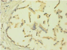 Polyclonal Rabbit anti-Human TIMP1 Antibody (IHC, WB)
