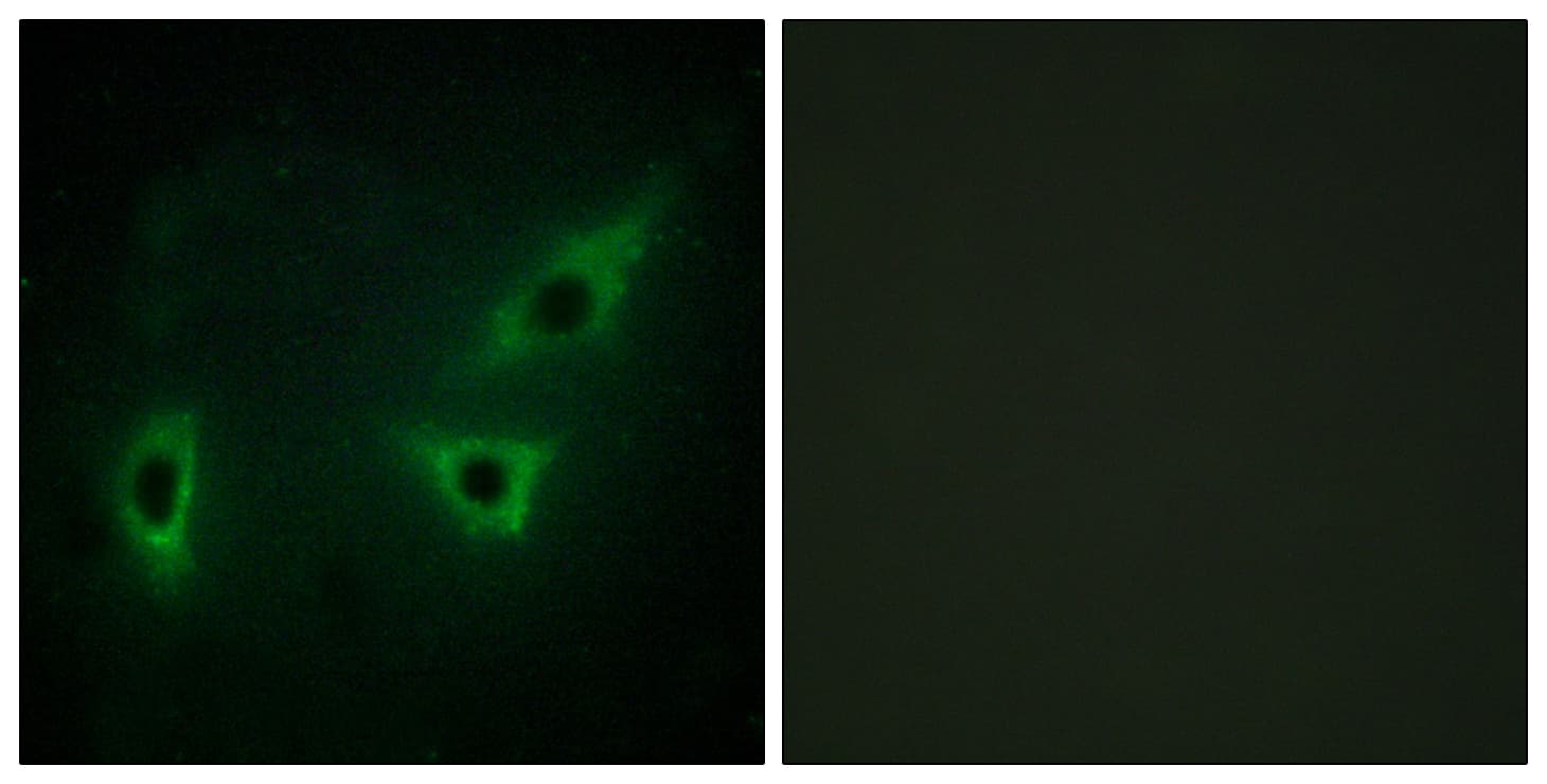 IHC-plus™ Polyclonal Rabbit anti-Human WC1 / ATP7B Antibody (aa161-210, IHC, IF)