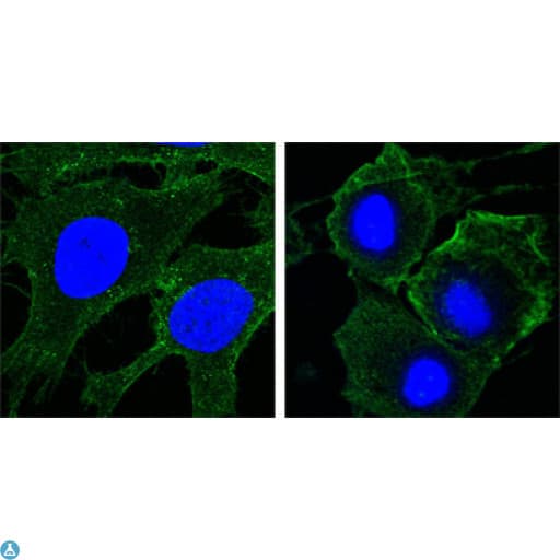 KDR / VEGFR2 / FLK1 Antibody