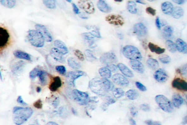 Polyclonal Rabbit anti-Human Histone H3 Antibody (phospho-Ser10, IHC, IF, WB)