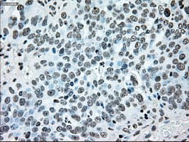 BRAF / B-Raf Antibody (clone OTI4C11)