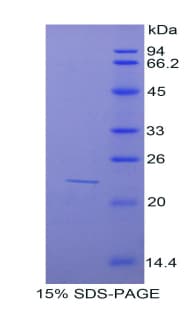 Mouse SUOX / Sulfite Oxidase Protein (Recombinant His)