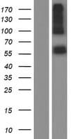 ALAS2 Protein (Over-Expression Lysate Myc-DDK (Flag))