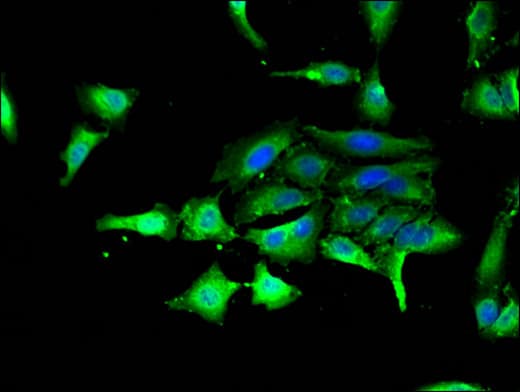 GSK3A / GSK3 Alpha Antibody