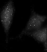 Polyclonal Rabbit anti-Human UVRAG Antibody (aa120-152, IHC, IF, WB)