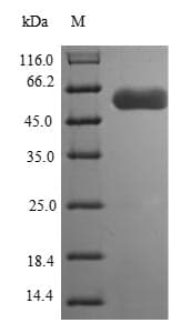 Campylobacter jejuni flaB Protein (Recombinant 6His, C-terminus)