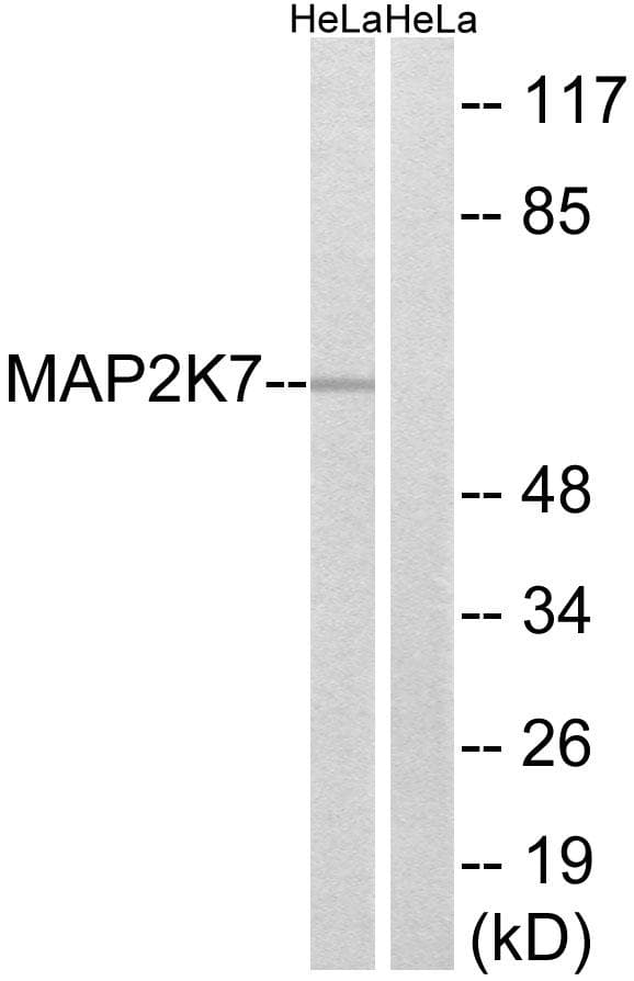 Polyclonal Rabbit anti-Human MAP3K7 / TAK1 Antibody (p271, WB)