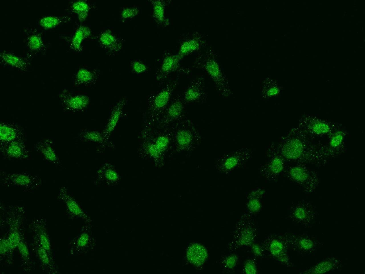 Polyclonal Rabbit anti-Human FBXO27 Antibody (IF)