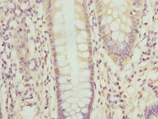 OPHN1 Antibody