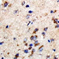 Polyclonal Rabbit anti-Human ZFAND3 / TEX27 Antibody (IHC, WB)
