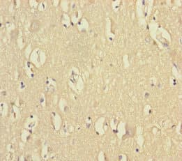 VPS33B Antibody