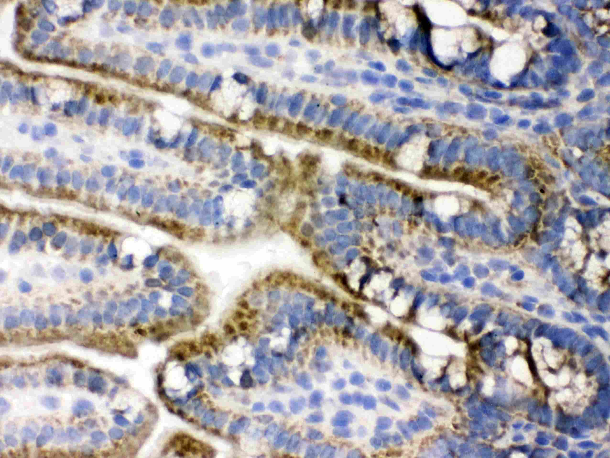PDPK1 / PDK1 Antibody (aa524-556)