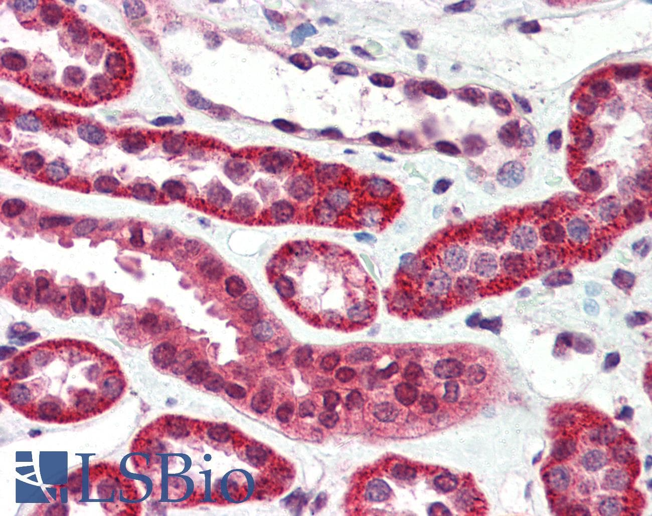 PathPlus™ Monoclonal Mouse anti-Human IGF1R / IGF1 Receptor Antibody (clone JBW902, aa1264-1367, IHC, WB)