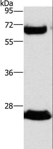 GGT1 / GGT Antibody (aa1-225)