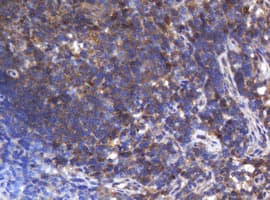 ASGR2 Antibody (clone OTI2A12)