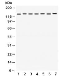 Polyclonal Rabbit anti-Human SMC3 / HCAP Antibody (IHC, WB)