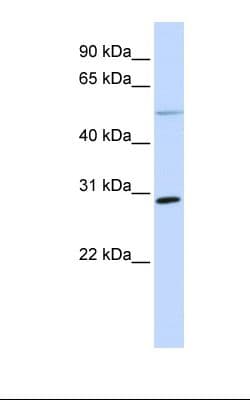 MFAP4 Antibody (aa74-123)